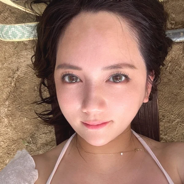 日焼け痛いよ〜