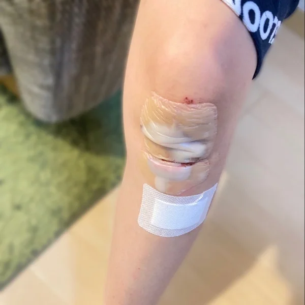 怪我によりお休みいただいてます😭