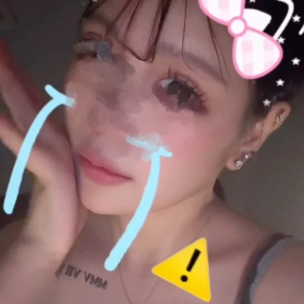 🥺