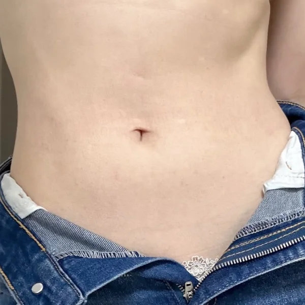 クビレ